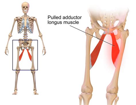 The movement at the joint depends on the anatomy of the joint and its axes of movement. Groin strain: Symptoms, treatment, and recovery