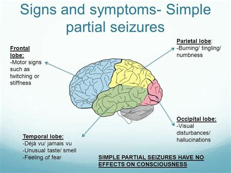 The two most common type of partial seizures are simple and complex partial seizures. Focal Onset Aware Seizures (Simple Partial Seizures) signs ...