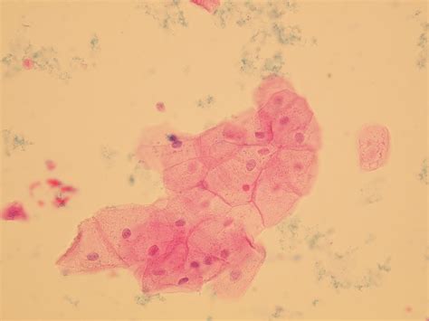 Epithelial cells are cells that come from surfaces of your body, such as your skin, blood vessels, urinary tract, or organs. Microscopic Analysis of Urine | Faculty of Medicine ...