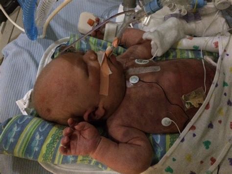 Strangers Raise Funds For Newborn Baby With Acute Myeloid Leukemia
