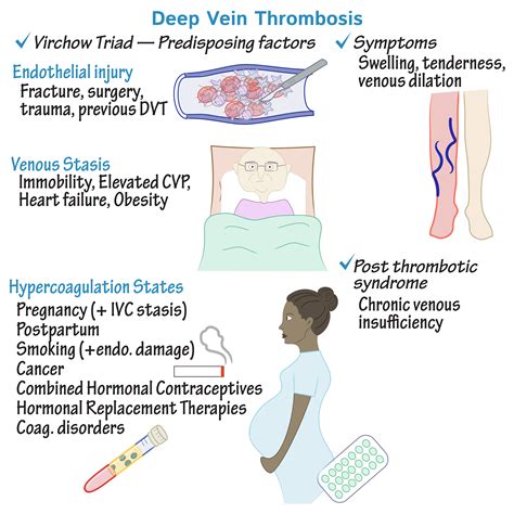 Pathology Glossary Deep Vein Thrombosis Draw It To Know It