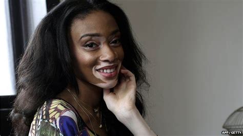 Vitiligo Model Winnie Harlow Becomes New York Catwalk Star Bbc Newsbeat