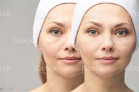 Pretty Mature Girl Before And After Portrait Anti Wrincle Healthy