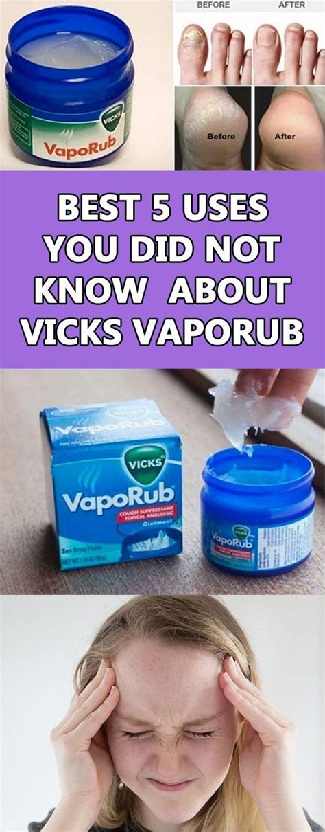 Most Surprising Advantages And Uses Of Vicks Vaporub Fix Naturally