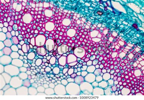 1878 Plant Vascular Tissue Microscope Images Stock Photos And Vectors