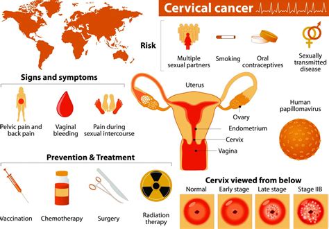 January is cervical cancer awareness month. Preventative screening is crucial for protecting against ...