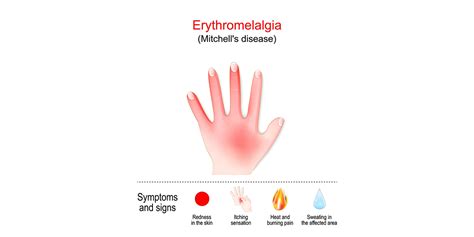 Erythromelalgia • The Blood Project