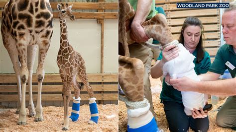 Baby Giraffe With Leg Abnormalities Outfitted With Special Therapeutic