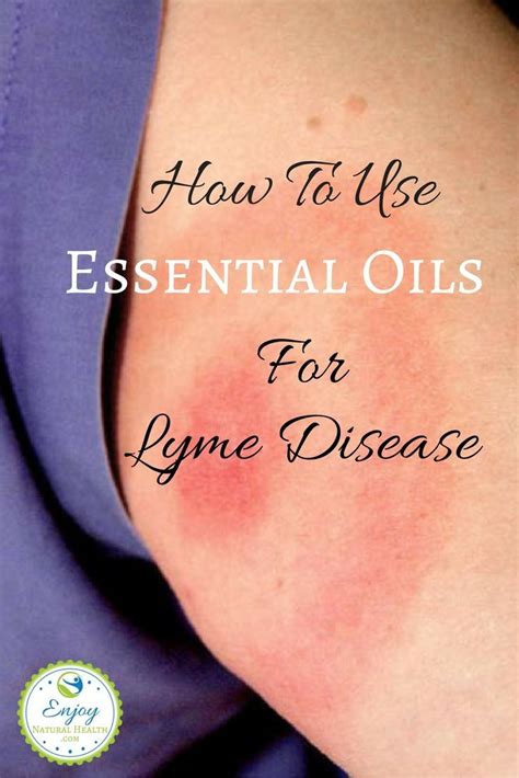 Essential Oils For Lyme Disease Lyme Disease Essential Oils Oregano