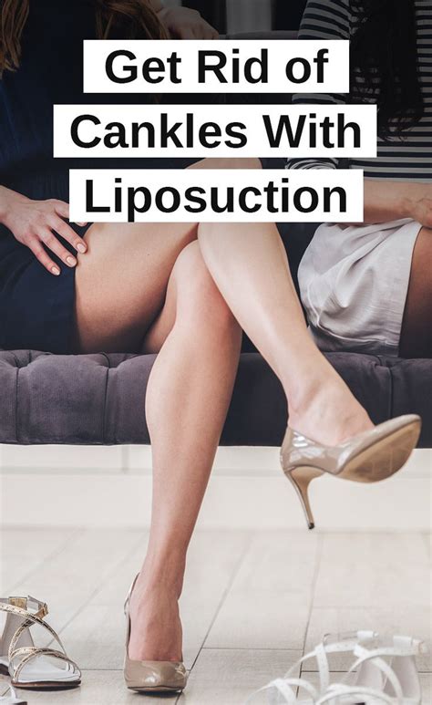 Get Rid Of Cankles With Liposuction Liposuction Liposuction Legs Before And After Liposuction