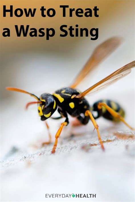 Wasp Sting Treatment 2021