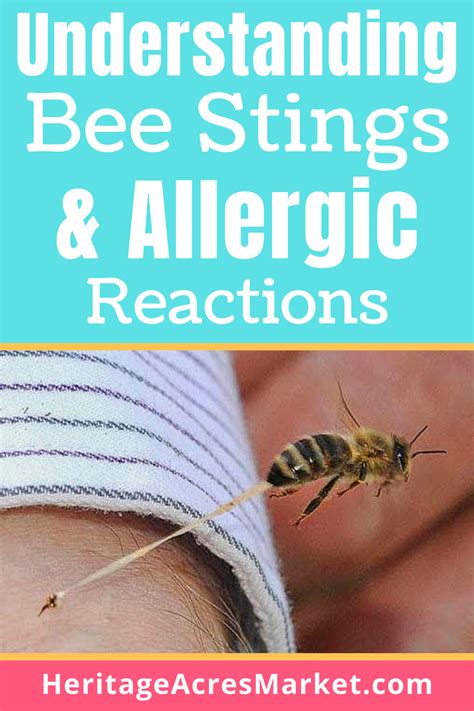 Allergic Reaction Yellow Jacket Sting Images Mageusi