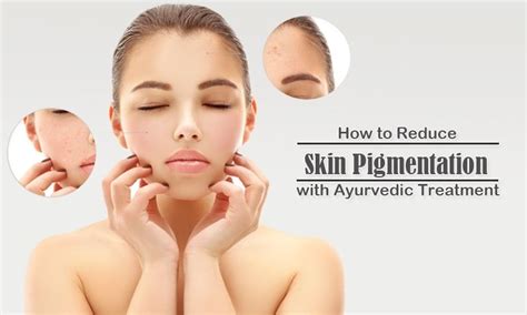 Skin Pigmentation Or Hyperpigmentation Is A Condition In Which The