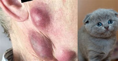 Doctors Warn Cat Owners They Are Spreading This Terrible Infection