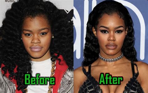 Teyana Taylor Before Surgery Did She Get Her Face Done