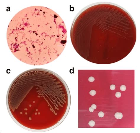 Appearances After 24 H And 48 H Incubation On Blood Agar Plates A Gram