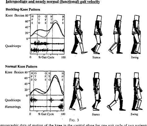 Figure 3 From Gait Pattern In The Early Recovery Period After Stroke Semantic Scholar