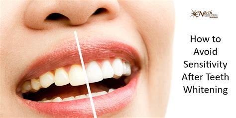 how to avoid sensitivity after teeth whitening north pointe dental