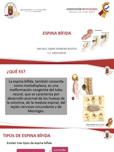 Espina Bífida Corregida Pdf Especialidades Medicas Medicina Clinica