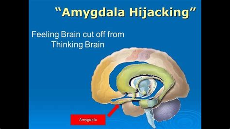 When Was Your Last Amygdala Hijack At What Cost Youtube