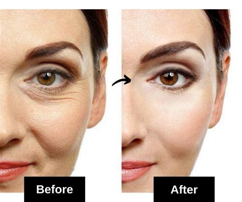 How To Reduce Wrinkles Under Eyes 59 Personalized Wedding Ideas We Love