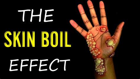 The Skin Boil Effect Time Lapse Youtube