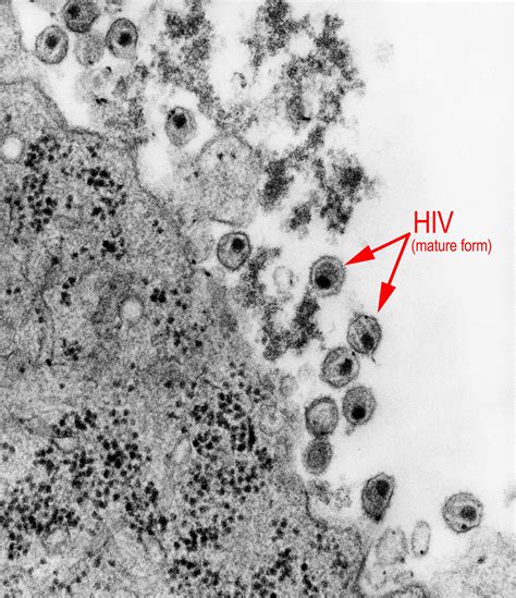 Electron Micrograph Of Hiv Mature Form Biology Of Human World Of Viruses