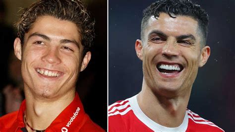 Cristiano Ronaldo Smile Transformation Before And After What Has The Footballer Done To His