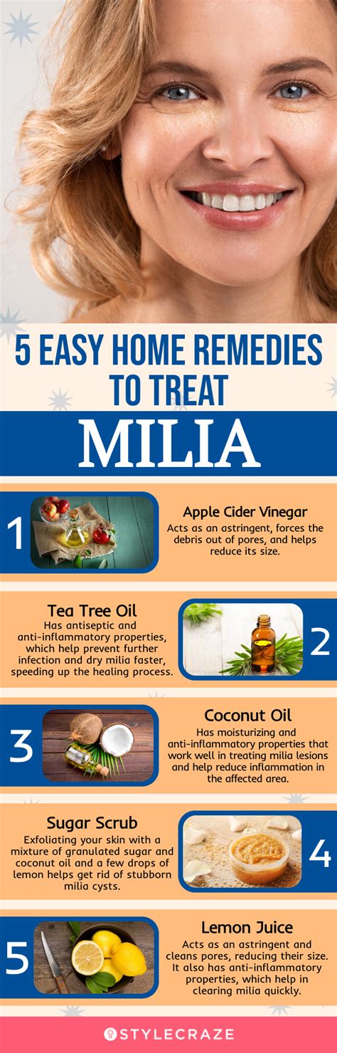 How To Get Rid Of Milia At Home And Prevention Tips