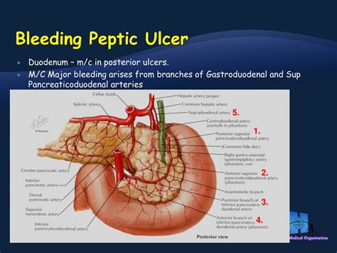 Ppt Gastrointestinal Bleeding Powerpoint Presentation Free Download