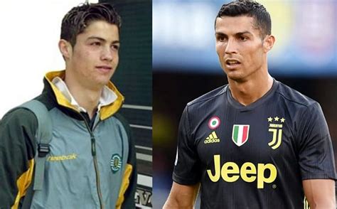 Cristiano Ronaldo Y Sus Cirugías Plásticas Según Médico Colombiano