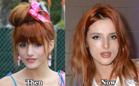 Bella Thorne Plastic Surgery Before And After Photos