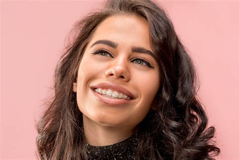 Top 10 Braces Questions And Answers Smith Orthodontics