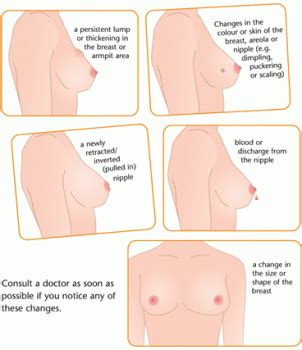 Prostate cancer is a serious disease that affects thousands of men over the age of 65. How to tell if you have breast cancer | ENCOGNITIVE.COM