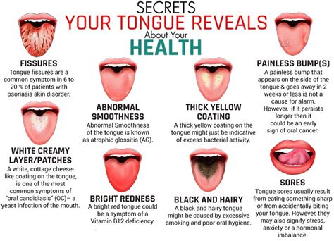 What Your Tongue Says About Your Health Astro Ulagam