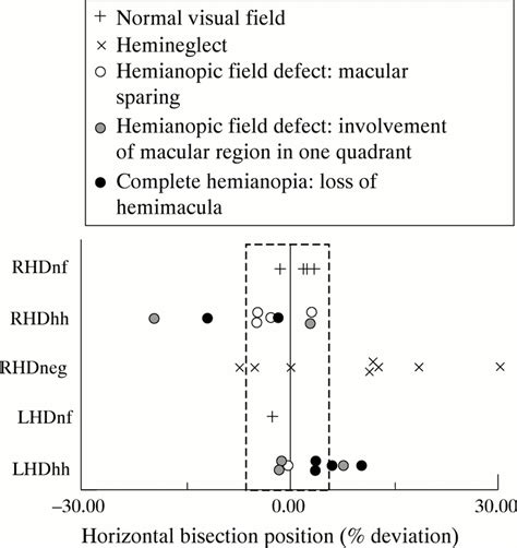 Tests of visual inattention a simple task wherein the examinee is asked to draw a line that bisects lines of varying length. Line bisection in hemianopia | Journal of Neurology ...