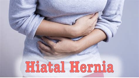 Hiatal Hernia Cause And Solution Youtube