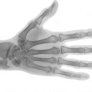 X Ray PNG Transparent HD Photo | PNG All