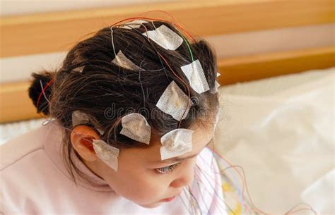 Girl With Eeg Electrodes Attached To Her Head For Medical Test Stock