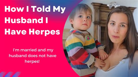How I Told My Husband I Have Herpes Life With Herpes