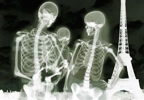 fotos de raio X que farão você enxergar o corpo de outra forma