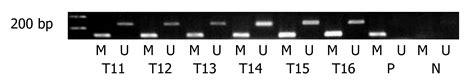 Two Distinct Pathways Of P16 Gene Inactivation In Gallbladder Cancer