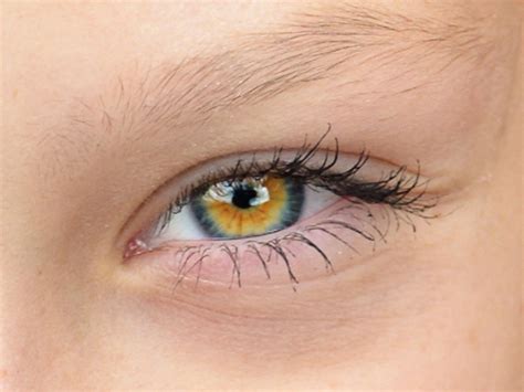Gorgeous Central Heterochromia Eyes Beautiful Eyes Color