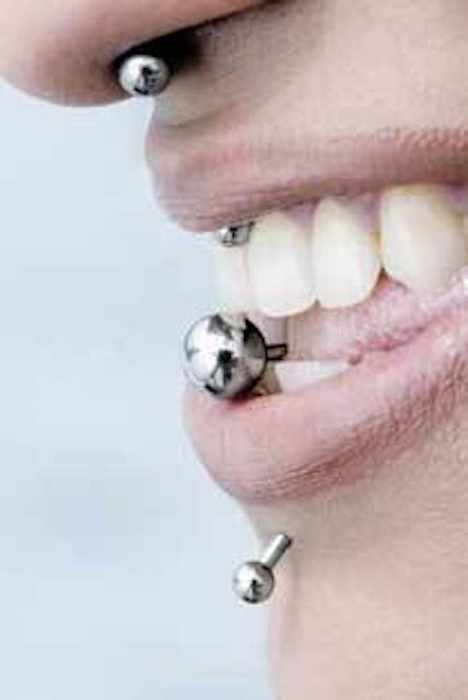 The Perils Of Oral Piercing Registered Dental Hygienist