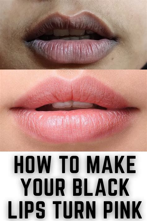 How To Turn Black Lips Into Pink Naturally In 2021 Black Lips Lip