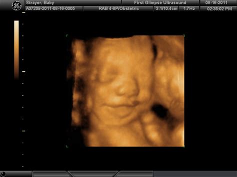 Our Miracle Life 29 Week 4d Ultrasound