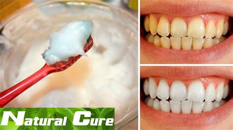 Natural Cure How To Naturally Whiten Your Teeth At Home In 3 Minutes Youtube