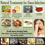 Sinus Migraine Natural Treatment