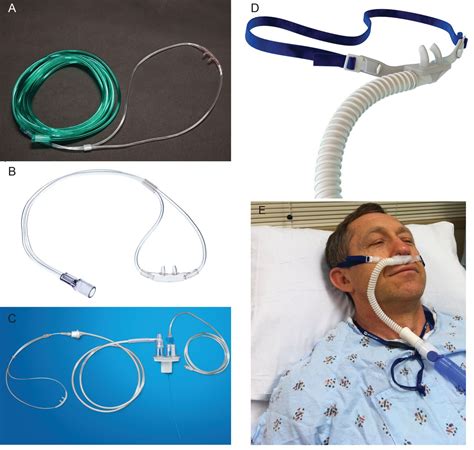 High Flow Oxygen Administration By Nasal Cannula For Adult And