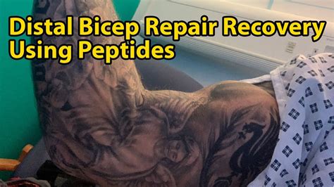 Vlog 1 Day 12 Distal Bicep Repair Recovery Using Peptides Bpc157